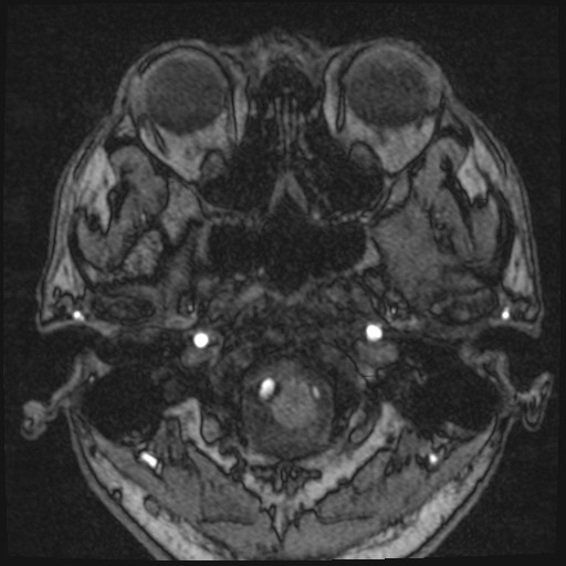 Click on the Serie image to view the images of VILLANUEVA, WILLIAM A.